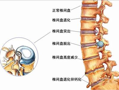 养老院一般多少钱一月_养老机构排名_养老院图片_五色旗养老网