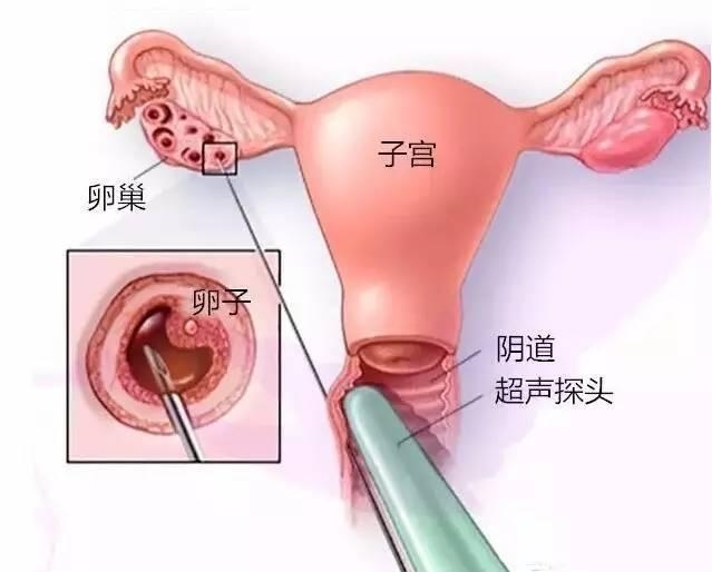 播种网-专业备孕服务商_备孕知识_妈妈备孕经验分享