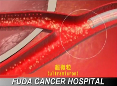 广州复大肿瘤医院_国家临床重点肿瘤专科_JCI认证医院_广州肿瘤医院
